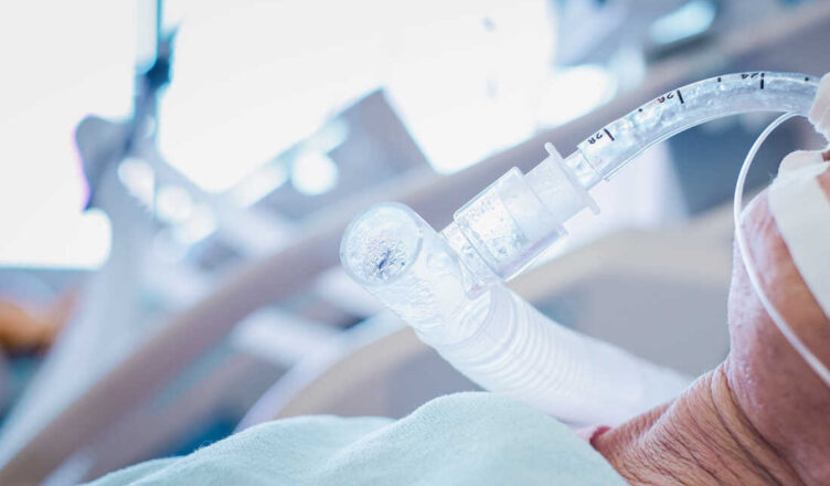 ECMO Treatment Helps To Keep A Person Alive